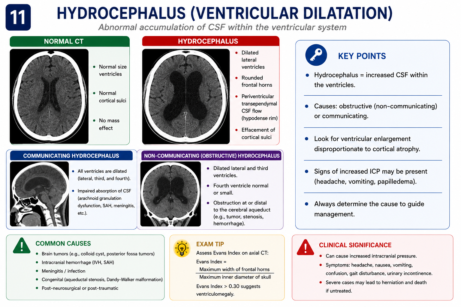 Post-traumatic hydrocephalus on CT