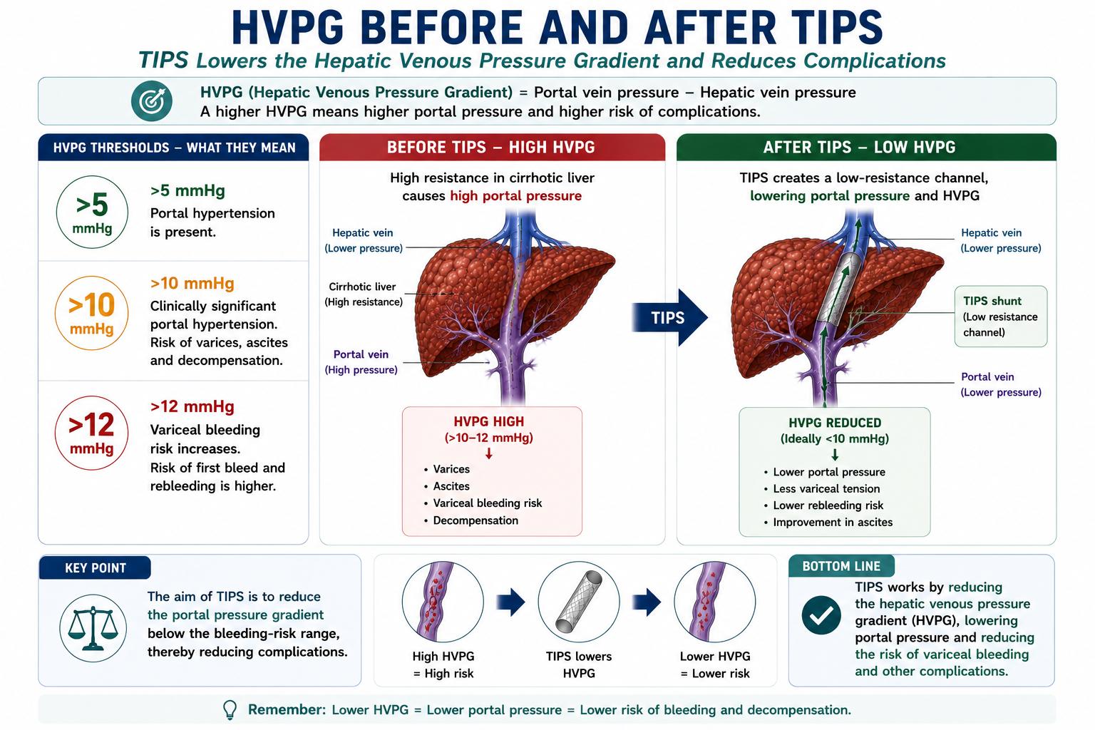Infographic showing HVPG thresholds before and after TIPS including clinically significant portal hypertension and bleeding risk reduction after portal pressure falls